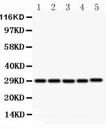 Western blot - Anti-TRAP/CD40L antibody (AB65854), expandable thumbnail