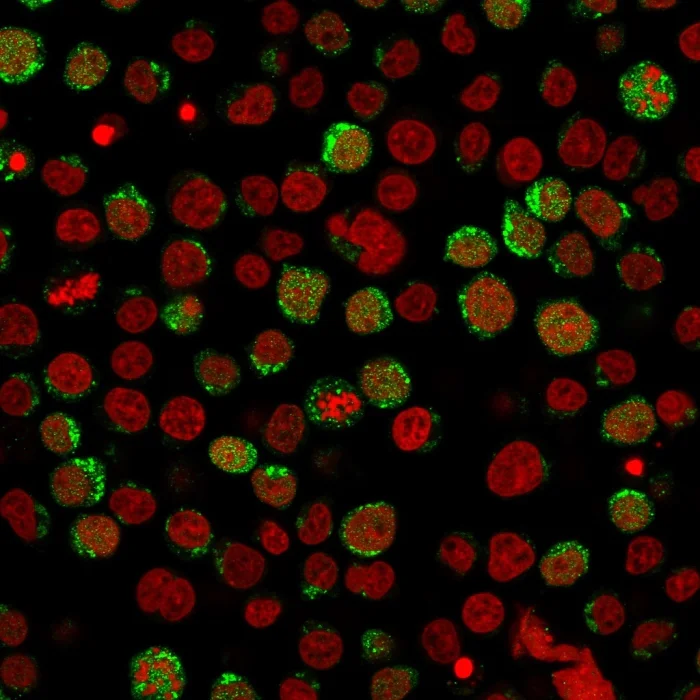 Immunocytochemistry - Anti-TRAP/CD40L antibody [CD40LG/2761] - BSA and Azide free (AB259254)