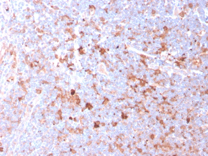 Immunohistochemistry - Anti-TRAP/CD40L antibody [CD40LG/2761] - BSA and Azide free (AB259254)