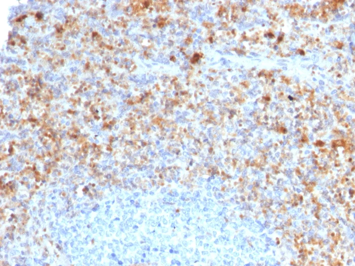 Immunohistochemistry - Anti-TRAP/CD40L antibody [CD40LG/2761] - BSA and Azide free (AB259254)