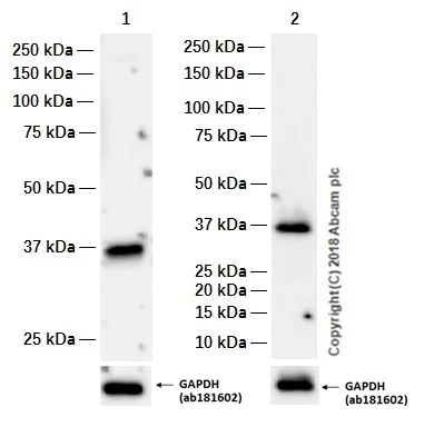 Western blot - Anti-TRAP/CD40L antibody [EP462E] (AB52750)