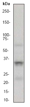 Western blot - Anti-TRAP/CD40L antibody [EP462E] - BSA and Azide free (AB210743)