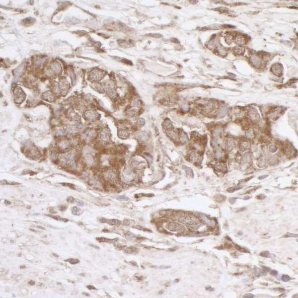 Immunohistochemistry (Formalin/PFA-fixed paraffin-embedded sections) - Anti-TRAP1 antibody (AB226401)