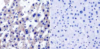 Immunohistochemistry (Formalin/PFA-fixed paraffin-embedded sections) - Anti-TRAP1 antibody [TRAP1-6] (AB2721)