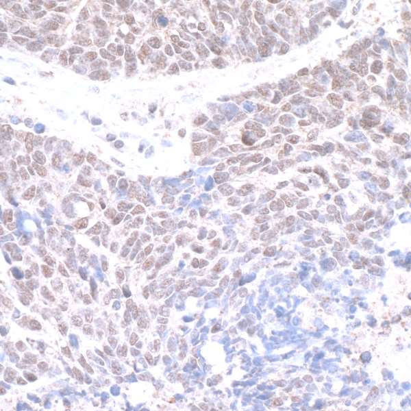 Immunohistochemistry (Formalin/PFA-fixed paraffin-embedded sections) - Anti-TRAP220/MED1 antibody (AB245546)