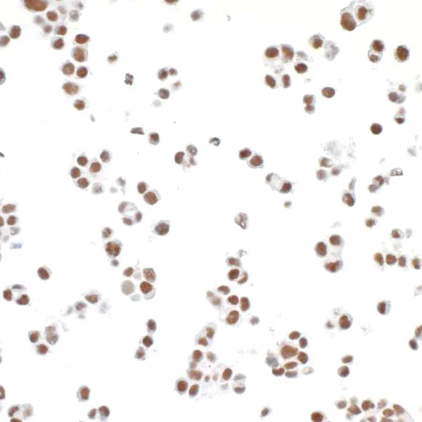 Immunocytochemistry - Anti-TRAP220/MED1 antibody [BLR037F] (AB243893)