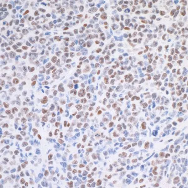 Immunohistochemistry (Formalin/PFA-fixed paraffin-embedded sections) - Anti-TRAP220/MED1 antibody [BLR037F] (AB243893)