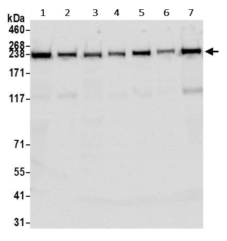 Western blot - Anti-TRAP220/MED1 antibody [BLR037F] (AB243893)