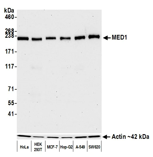 Western blot - Anti-TRAP220/MED1 antibody [BLR037F] (AB243893)
