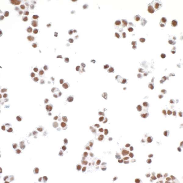 Immunocytochemistry - Anti-TRAP220/MED1 antibody [BLR037F] - BSA free (AB272086)