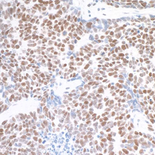 Immunohistochemistry (Formalin/PFA-fixed paraffin-embedded sections) - Anti-TRAP220/MED1 antibody [BLR037F] - BSA free (AB272086)