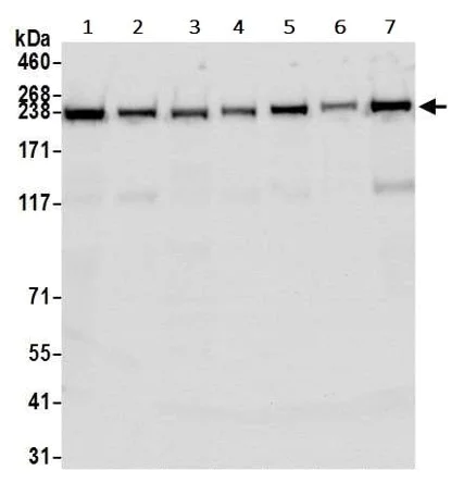 Western blot - Anti-TRAP220/MED1 antibody [BLR037F] - BSA free (AB272086)