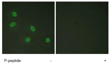 Immunocytochemistry/ Immunofluorescence - Anti-TRAP220/MED1 (phospho T1457) antibody (AB60950)