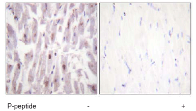 Immunohistochemistry (Formalin/PFA-fixed paraffin-embedded sections) - Anti-TRAP220/MED1 (phospho T1457) antibody (AB60950)