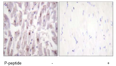 Immunohistochemistry (Formalin/PFA-fixed paraffin-embedded sections) - Anti-TRAP220/MED1 (phospho T1457) antibody (AB60950)