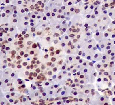 Immunohistochemistry (Formalin/PFA-fixed paraffin-embedded sections) - Anti-TRAP220/MED1 (phospho T1457) antibody [EPR13269] (AB181103)