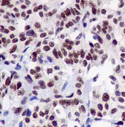 Immunohistochemistry (Formalin/PFA-fixed paraffin-embedded sections) - Anti-TRAP220/MED1 (phospho T1457) antibody [EPR13269] (AB181103)