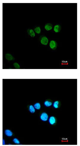 Immunocytochemistry/ Immunofluorescence - Anti-TRAP80 antibody (AB155593)