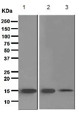 Western blot - Anti-TRAPPC2 antibody [EPR3401] (AB111848)
