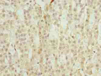 Immunohistochemistry (Formalin/PFA-fixed paraffin-embedded sections) - Anti-TRAPPC6B antibody (AB235394)