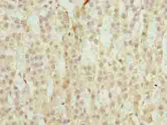 Immunohistochemistry (Formalin/PFA-fixed paraffin-embedded sections) - Anti-TRAPPC6B antibody (AB235394)