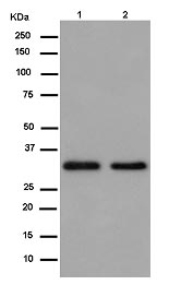 Western blot - Anti-TRAX antibody [EPR13929(B)] (AB181862), expandable thumbnail