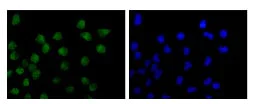 Immunocytochemistry/ Immunofluorescence - Anti-TRAX antibody [EPR13929(B)] - BSA and Azide free (AB250532)