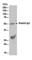Immunoprecipitation - Anti-TRAX antibody [EPR13929(B)] - BSA and Azide free (AB250532)