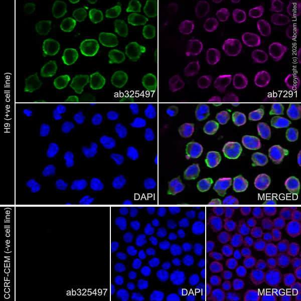 Immunocytochemistry/ Immunofluorescence - Anti-TRBC1 antibody [EPR24928-52] (AB325497)