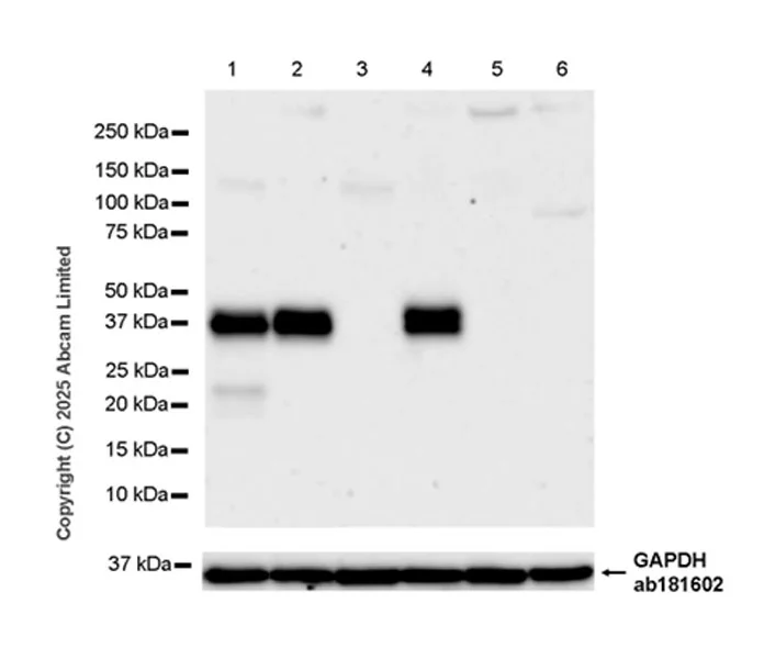 Western blot - Anti-TRBC1 antibody [EPR24928-52] (AB325497)