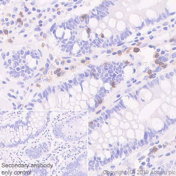 Anti-TRBC1 antibody [SP305]