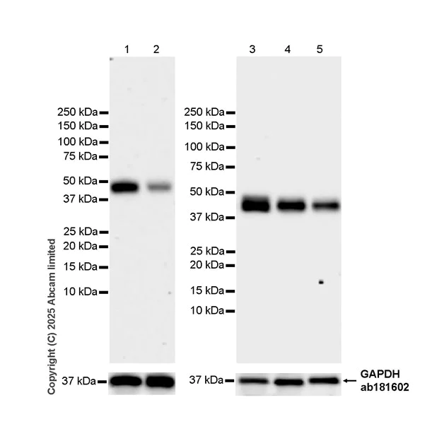 Western blot - Anti-TRBP antibody [EPR29899-84] (AB324950)