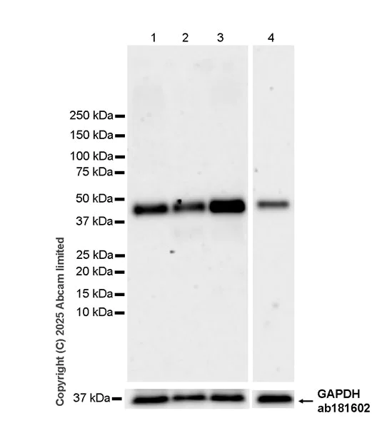 Western blot - Anti-TRBP antibody [EPR29899-84] (AB324950)