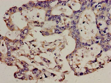 Immunohistochemistry (Formalin/PFA-fixed paraffin-embedded sections) - Anti-TRBV7-9 antibody (AB235044)