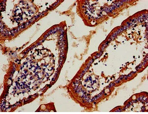 Immunohistochemistry (Formalin/PFA-fixed paraffin-embedded sections) - Anti-TRBV7-9 antibody (AB235044)