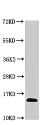 Western blot - Anti-TRBV7-9 antibody (AB235044)