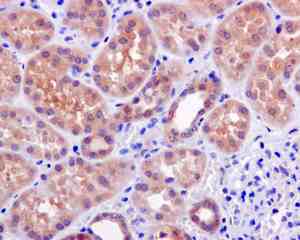 Immunohistochemistry (Formalin/PFA-fixed paraffin-embedded sections) - Anti-TRC40 antibody [EPR11422] (AB169549)
