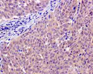 Immunohistochemistry (Formalin/PFA-fixed paraffin-embedded sections) - Anti-TRC40 antibody [EPR11422] (AB169549)
