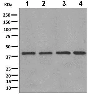 Western blot - Anti-TRC40 antibody [EPR11422] (AB169549)