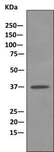 Western blot - Anti-TRC40 antibody [EPR11422] (AB169549)