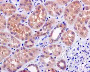 Immunohistochemistry (Formalin/PFA-fixed paraffin-embedded sections) - Anti-TRC40 antibody [EPR11422] - BSA and Azide free (AB249499)