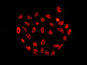 Immunocytochemistry/ Immunofluorescence - Anti-TRC40 antibody [EPR11423] - BSA and Azide free (AB249491)