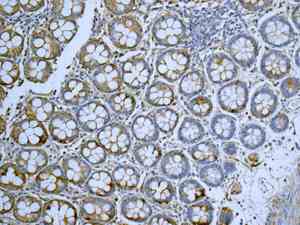Immunohistochemistry (Formalin/PFA-fixed paraffin-embedded sections) - Anti-TRC40 antibody [EPR11423] - BSA and Azide free (AB249491), expandable thumbnail