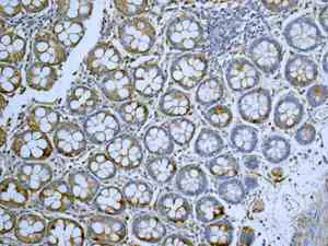 Immunohistochemistry (Formalin/PFA-fixed paraffin-embedded sections) - Anti-TRC40 antibody [EPR11423] - BSA and Azide free (AB249491)