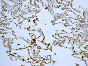 Immunohistochemistry (Formalin/PFA-fixed paraffin-embedded sections) - Anti-TRC40 antibody [EPR11423] - BSA and Azide free (AB249491), expandable thumbnail