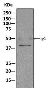 Immunoprecipitation - Anti-TRC40 antibody [EPR11423] - BSA and Azide free (AB249491)