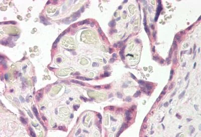 Immunohistochemistry (Formalin/PFA-fixed paraffin-embedded sections) - Anti-TRC8 antibody - C-terminal (AB189173)