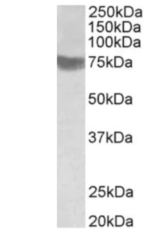 Western blot - Anti-TRC8 antibody - C-terminal (AB189173)