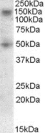 Western blot - Anti-TRC8 antibody - C-terminal (AB189173)