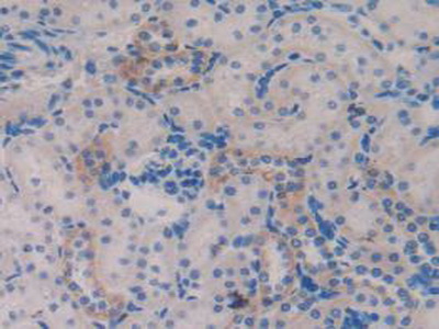 Immunohistochemistry (Formalin/PFA-fixed paraffin-embedded sections) - Anti-Trefoil Factor 3 antibody (AB231546)
